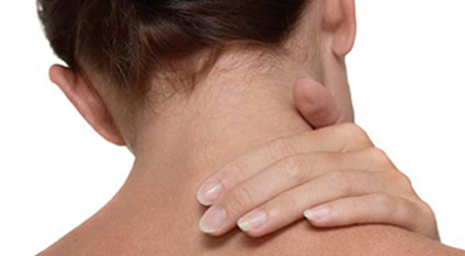 Chứng vẹo cổ - Hình ảnh minh họa